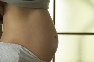 【症例】妊娠6ヶ月で強い腰痛（３０代女性）
